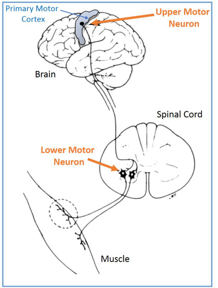 Upper Motor Neurons Contribute to ALS in Human Brain ...