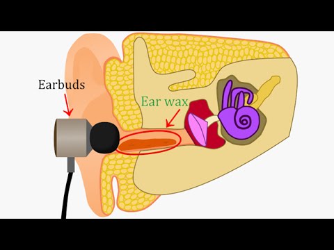 Putting Earbuds In Your Ears Is VERY Bad And Here's Why ...