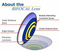 Multifocal / Bifocal