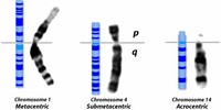 Metacentric Chromosomes