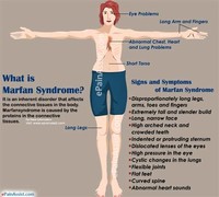 Marfan Syndrome,