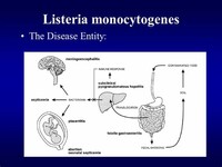 Listeria Monocytogenes