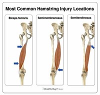 Hamstring Injuries