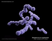 Streptococcus ​Agalactiae​
