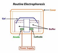 Routine Electrophoresis