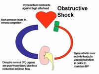Obstructive Shock