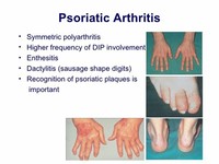 Symmetric Arthritis
