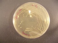 Streptococcus ​Oralis​