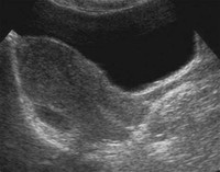 Obstetric and Gynecological Ultrasound