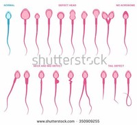 Sperm: $125 per Sample Shutterstock