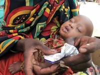 Ethiopia (Global Health Index: 244) 