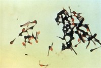 Clostridium ​Tetani​