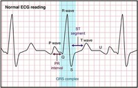 Electrocardiogram (ECG or EKG)