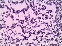Staphylococcus ​Pseudolugdunensis​