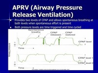 Airway Pressure Release Ventilation (APRV) 