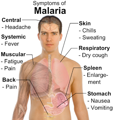 Malaria: Types Of Malaria, its Life Cycle, Signs and ...