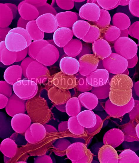 Staphylococcus haemolyticus, SEM - Stock Image C032/2350 ...