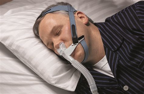 Sleep Apnea (OSA): The Causes, Symptoms And Treatment ...