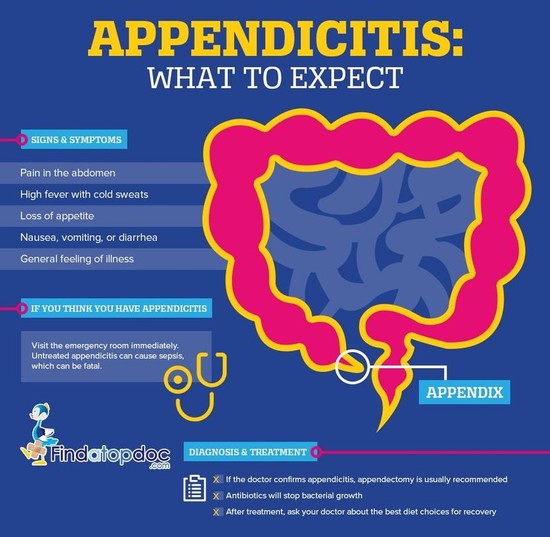 Where does the Pain Occur when you have Appendicitis?