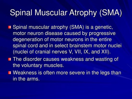 Spinal Muscular Atrophy Treatment - Bing images