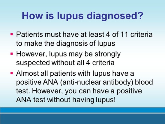 Lupus: Symptoms, Diagnosis and Treatment - ppt video ...