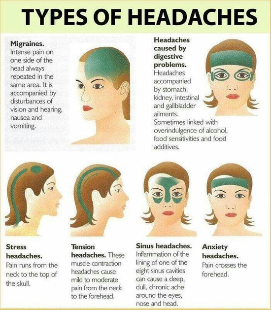 17+ best ideas about Headache Causes on Pinterest ...