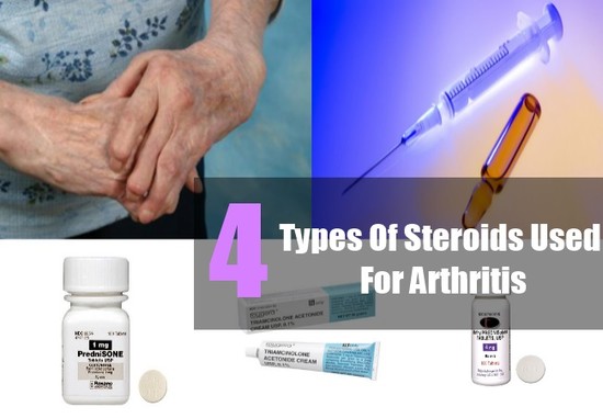 4 Types Of Steroids Used For Arthritis - How To Treat ...