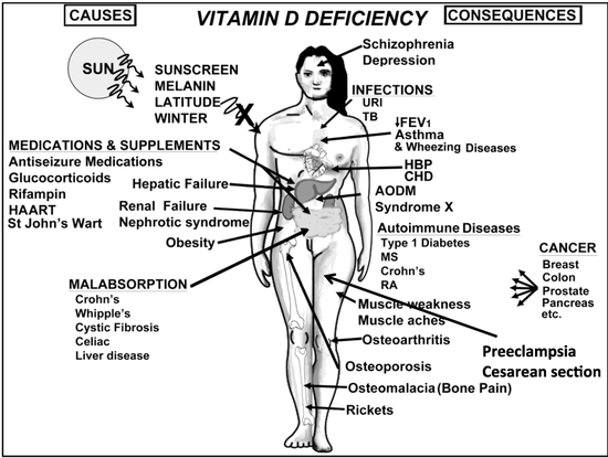 Nutrients | Free Full-Text | Vitamin D — Effects on ...