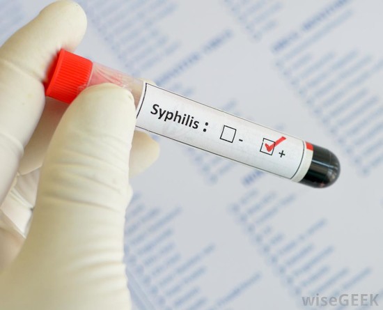 How Effective Is Doxycycline for Syphilis? (with pictures)