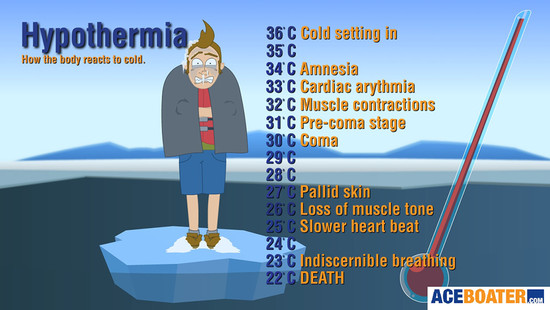 What is Hypothermia: What are the Causes, Symptoms and ...