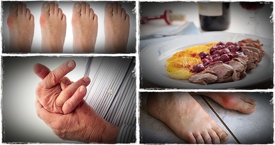 List of bad foods for gout for people to avoid, and get ...