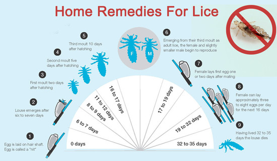 Home Remedies For Lice
