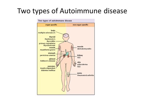 Autoimmunity and Autoimmune Disease - ppt video online ...