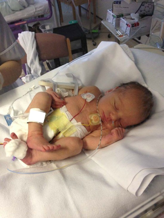 Photos: Then-and-now preemie stories will capture your ...
