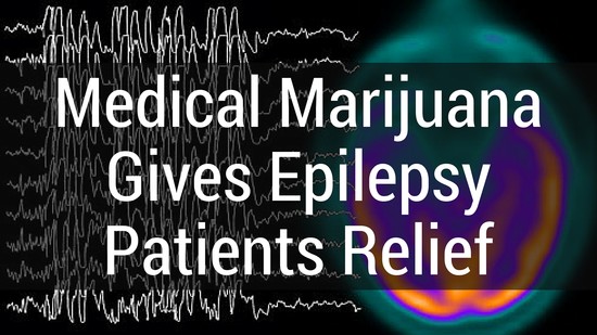 Medical Marijuana Gives Epilepsy Patients Relief