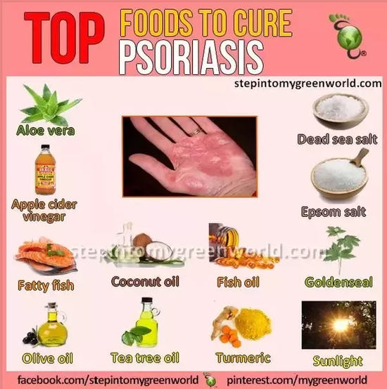 Is there a permanent cure for psoriasis? - Quora