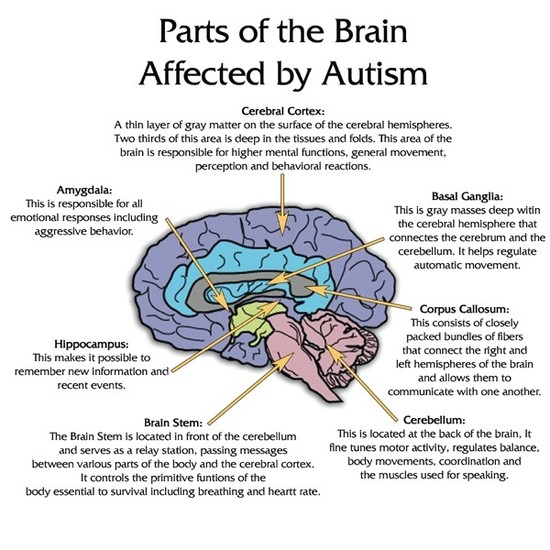 Parts of the Brain Affected by Autism | Understanding and ...