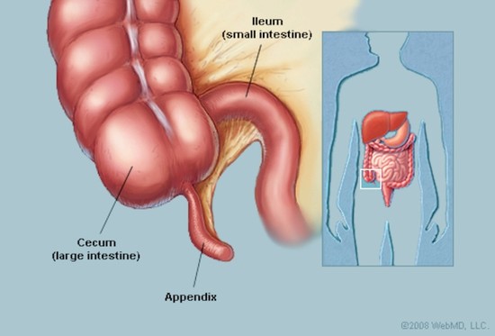 Appendix (Anatomy): Appendix Picture, Location, Definition ...