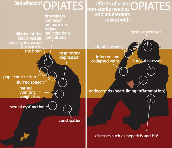 Health Effects of Opiate Addiction - Opiate.com