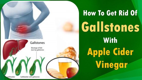 How To Get Rid Of Gallstones With Apple Cider Vinegar ...