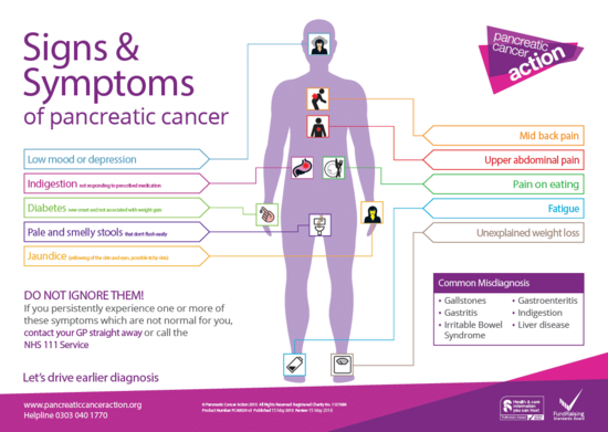 Pancreatic Cancer - Symptoms, Prevention and Treatments