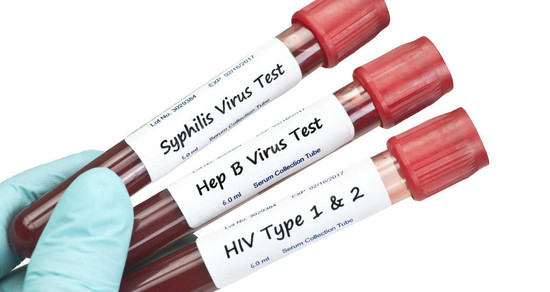 8 Things to Know About HIV/STI Testing