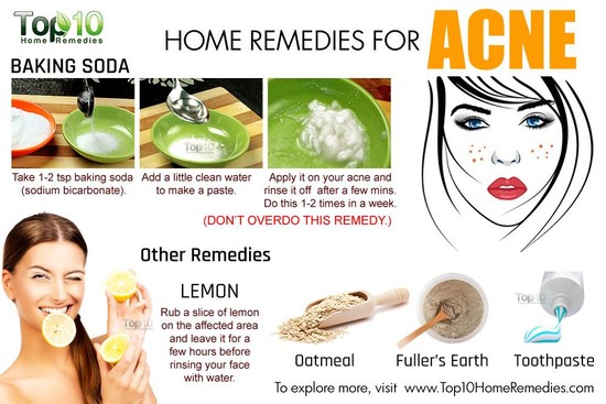 Home Remedies for Acne | Top 10 Home Remedies