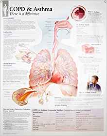 COPD/Asthma chart: Laminated Wall Chart: 9781930633452 ...