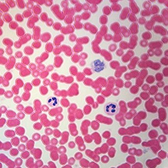 Human Blood Film Slide, Smear, H&E: Red Blood Cell Slides ...