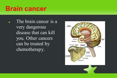 Brain Tumors By Joel Schroll, Jr.. What I already know ...
