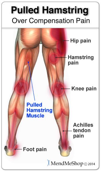 An injury to the hamstring will potentially lead to aches ...