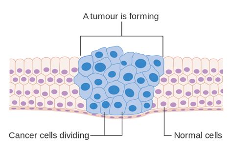 File:Diagram showing how cancer cells keep on reproducing ...