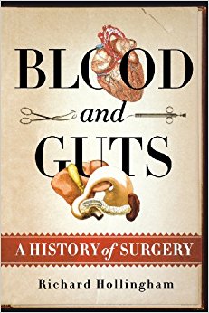 Blood and Guts: A History of Surgery: 9781250057730 ...