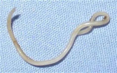 How to Get Rid of Roundworm?
